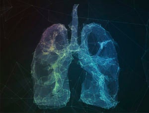 Low-dose CT Lung Cancer Screening