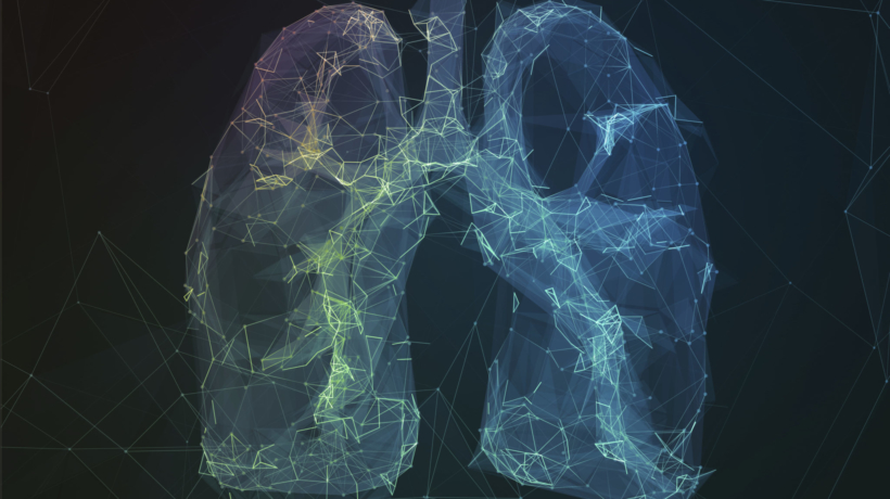 Low-dose CT Lung Cancer Screening