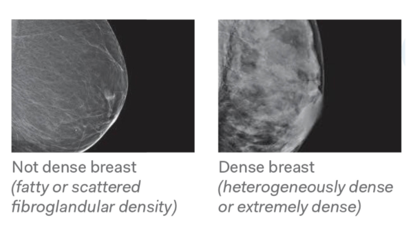 Breast Density Tra Medical Imaging 