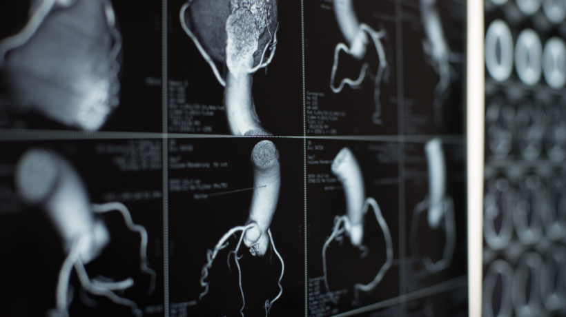 Section Spotlight – Cardiovascular and Thoracic Imaging