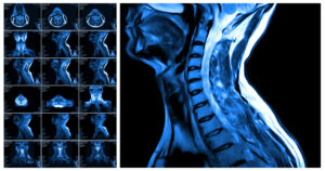 Section Spotlight: Neuroradiology 3