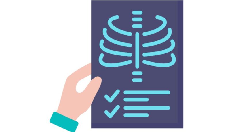 Decoding Your Imaging Report