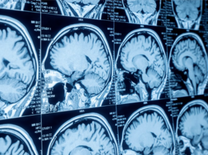 What Happens After Your Imaging Exam? A Radiologist’s Perspective 1