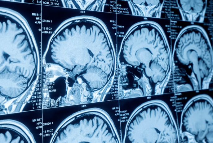 What Happens After Your Imaging Exam? A Radiologist’s Perspective 1